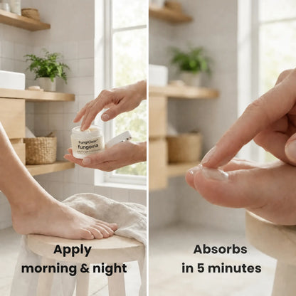 FungiClear Foot Cream — Athlete's Foot Routine