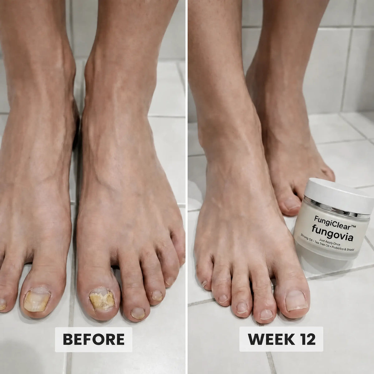 FungiClear Foot Cream — Athlete's Foot Routine