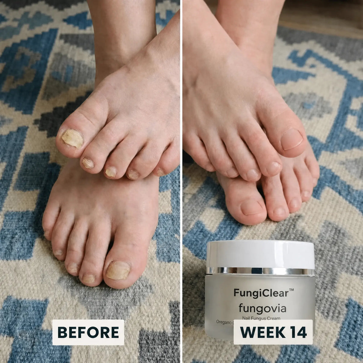 FungiClear - The First Formula Built To Actually Reach The Infection